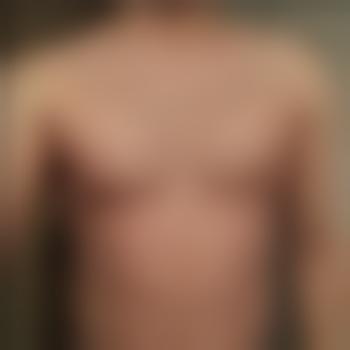 Tim-7322