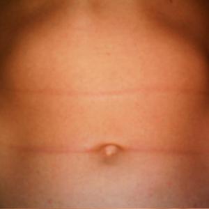 steiftier1980