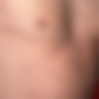 Fummel69