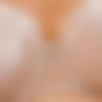 MissesSecret