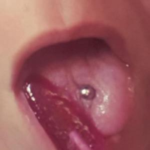 wonnepoppen002