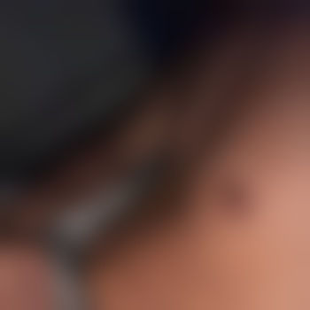 attention777