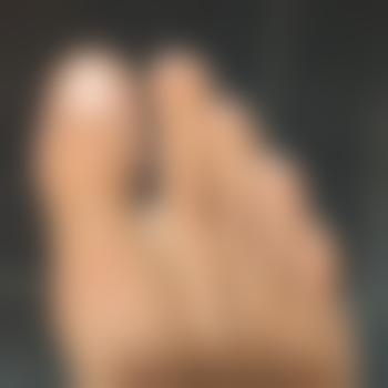 Max-5566