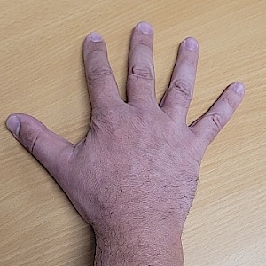ThenormalMen