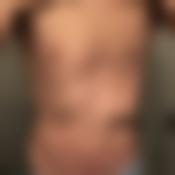 Anal56