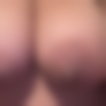 SxBbw