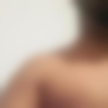 DerMark1