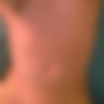 DerKleine35