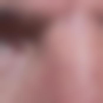 Tor72