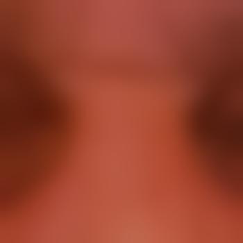 MichaDbg