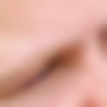 Stratic