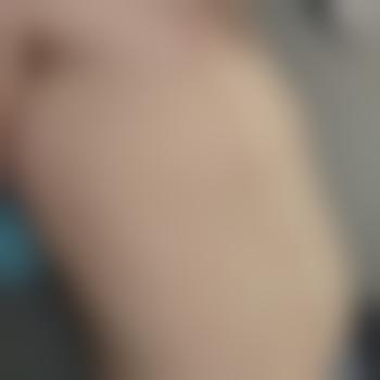 xxx81