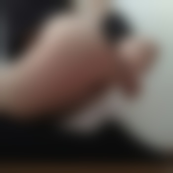 KinkyPoppers