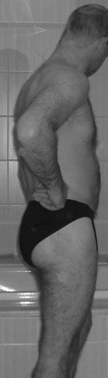 dehuler
