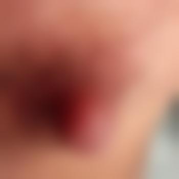netter_Typ