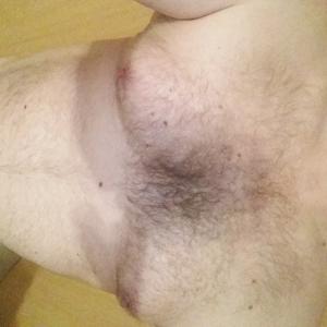 bityp68