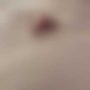 MolligPB
