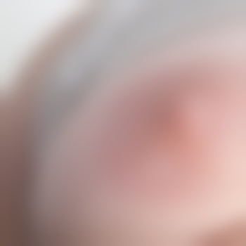 Bi-Paar-BGL