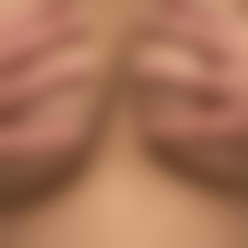 sr9578