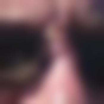 CXray
