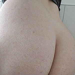 Axel430