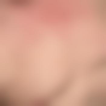 peter_35_m