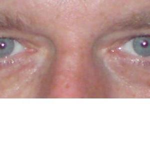 Malversuchen75