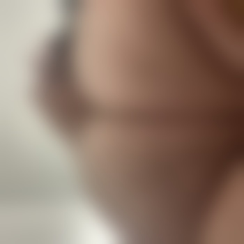 Ergeilsucht