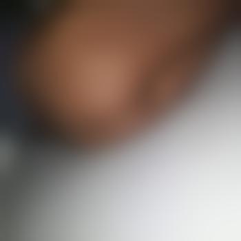 moacc_bi
