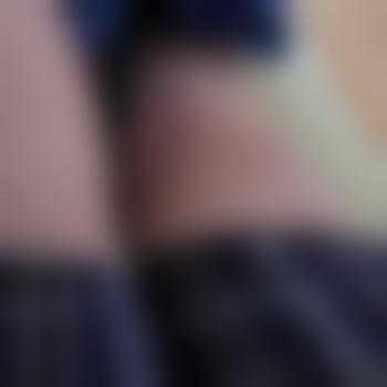 Myclitisbig