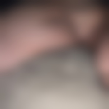 Steifebriese