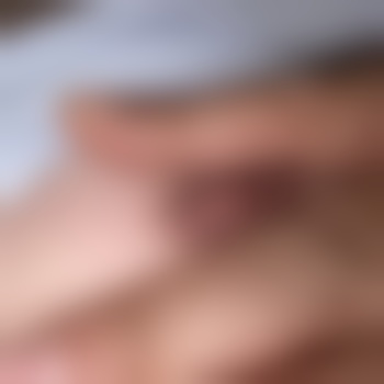 Markxl