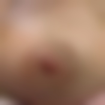 FeeTraum