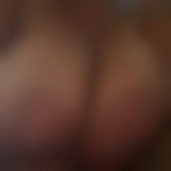 Mm7982