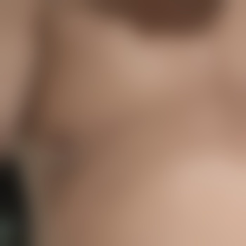 Erlebnis79