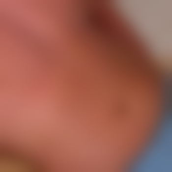 freakboy79
