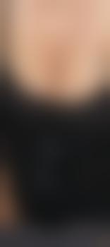 Rubensfanny