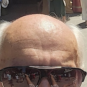 Gapoldy