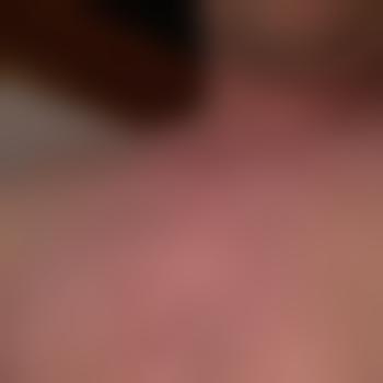 spalter