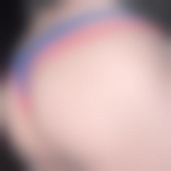Marcelanal