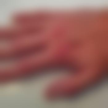 Fingerling